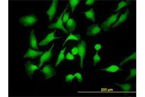 Immunofluorescence of monoclonal antibody to PBK on HeLa cell. (PBK antibody  (AA 1-110))