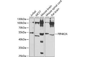 PIP4K2A antibody  (AA 120-350)