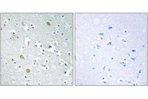 Immunohistochemistry analysis of paraffin-embedded human brain, using PLA1A Antibody. (PLA1A antibody  (AA 381-430))