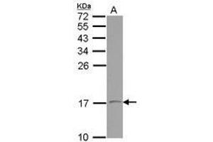 Image no. 2 for anti-Vesicle-Associated Membrane Protein 1 (Synaptobrevin 1) (VAMP1) (AA 1-105) antibody (ABIN1501694) (VAMP1 antibody  (AA 1-105))