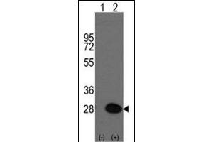 Western blot analysis of HSPB1(arrow) using rabbit polyclonal HSPB1 Antibody (S83) (ABIN391296 and ABIN2841333).