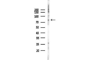 Western blot analysis of lysates from K562 cells(UV 30 min treatment), using TBX3 Antibody at 1/1000 dilution.