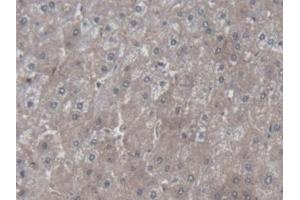 Detection of SYMPK in Human Liver Tissue using Polyclonal Antibody to Symplekin (SYMPK) (Symplekin antibody  (AA 1-347))