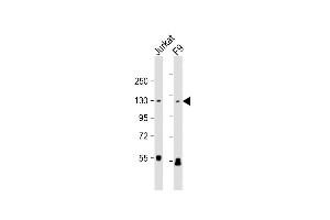 All lanes : Anti-SIRT1 Antibody at 1:1000 dilution Lane 1: Jurkat whole cell lysate Lane 2: F9 whole cell lysate Lysates/proteins at 20 μg per lane. (SIRT1 antibody  (AA 1-180))