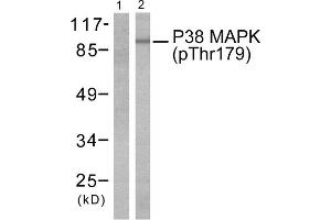 Western blot analysis of extracts from Hela cells treated with TNF- alpha (20ng/ml, 5mins), using P38 MAPK (phospho-Thr180) antibody (Line 1 and 2). (MAPK14 antibody  (pThr180))