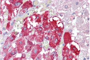 ABIN185693 (2. (TPTE antibody  (Internal Region))