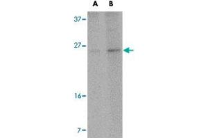 Western blot analysis of RCAN2 in NIH/3T3 cell lysate with RCAN2 polyclonal antibody  at (A) 1 and (B) 2 ug/mL .
