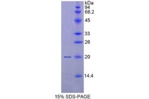 SDS-PAGE of Protein Standard from the Kit  (Highly purified E. (MMP 9 ELISA Kit)
