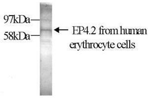Western Blot (10% gel) with the anti-transglutaminase antibody EP4. (EPB42 antibody)