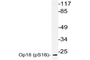 Western blot (WB) analyzes of Op18 antibody in extracts from 293 cells. (Stathmin 1 antibody  (pSer16))