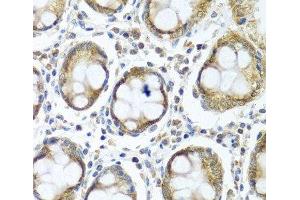 Immunohistochemistry of paraffin-embedded Human colon using IFI44 Polyclonal Antibody at dilution of 1:100 (40x lens). (IFI44 antibody)