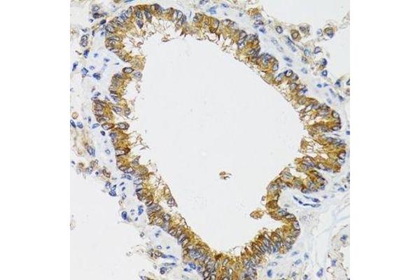 CHMP4B antibody  (AA 1-224)