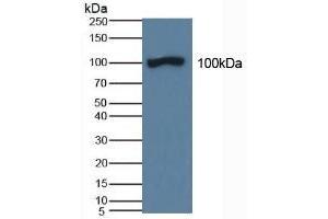 Detection of ABP1 in Porcine Kidney Tissue using Polyclonal Antibody to Amiloride Binding Protein 1 (ABP1) (DAO antibody  (AA 347-466))