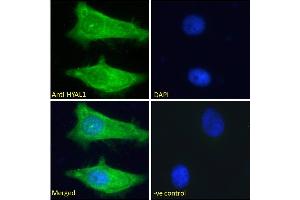 ABIN334421 Immunofluorescence analysis of paraformaldehyde fixed HeLa cells, permeabilized with 0. (HYAL1 antibody  (Internal Region))
