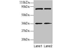 Western blot All lanes: HNRNPH1 antibody at 2 μg/mL Lane 1: EC109 whole cell lysate Lane 2: 293T whole cell lysate Secondary Goat polyclonal to rabbit IgG at 1/15000 dilution Predicted band size: 50 kDa Observed band size: 36 kDa (HNRNPH1 antibody  (AA 2-216))