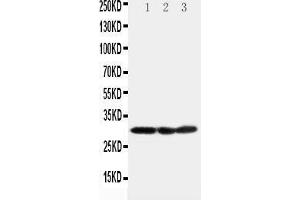 Anti-COMT antibody, Western blotting Lane 1: HELA Cell Lysate Lane 2: A375 Cell Lysate Lane 3: PANC Cell Lysate (COMT antibody  (N-Term))