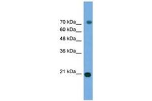 Image no. 1 for anti-Mitogen-Activated Protein Kinase 6 (MAPK6) (AA 395-444) antibody (ABIN6746449) (MAPK6 antibody  (AA 395-444))