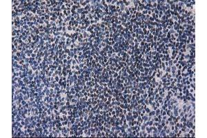 Immunohistochemistry (IHC) image for anti-Ankyrin Repeat Domain 53 (ANKRD53) (AA 1-300) antibody (ABIN1490720) (ANKRD53 antibody  (AA 1-300))