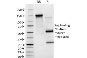 SDS-PAGE Analysis Purified Blood Group B Monoclonal Antibody (HEB-20). (ABO antibody)