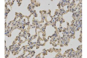 Immunohistochemistry (IHC) image for anti-Complement Component 1, Q Subcomponent Binding Protein (C1QBP) antibody (ABIN1871379)
