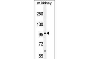 MED25 Antibody (N-term) (ABIN654162 and ABIN2844026) western blot analysis in mouse kidney tissue lysates (35 μg/lane). (MED25 antibody  (AA 112-140))