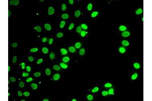 Immunofluorescence analysis of HeLa cells using SEPT7 antibody (ABIN6291642). (Septin 7 antibody)