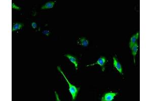 Immunofluorescent analysis of U251 cells using ABIN7171850 at dilution of 1:100 and Alexa Fluor 488-congugated AffiniPure Goat Anti-Rabbit IgG(H+L) (Tetraspanin 14 antibody  (AA 114-215))