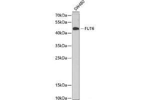Western blot analysis of extracts of SW480 cells using FUT6 Polyclonal Antibody at dilution of 1:1000.