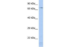 WB Suggested Anti-SRP72 Antibody Titration:  0. (SRP72 antibody  (Middle Region))