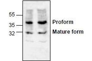 AP26354PU-N: Western blot analysis of LOX-1 expression in Jurkat cell lysate. (OLR1 antibody  (N-Term))