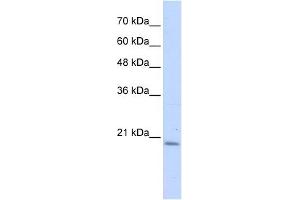PFDN6 antibody used at 1 ug/ml to detect target protein.