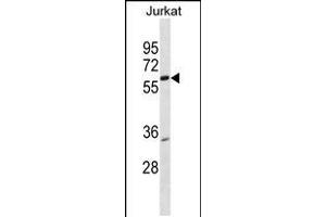Western blot analysis in Jurkat cell line lysates (35ug/lane). (PKNOX2 antibody  (AA 298-324))
