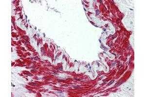 Anti-TRPM8 antibody IHC of human lung, vessel. (TRPM8 antibody  (N-Term))