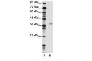 Image no. 1 for anti-Zinc Finger Protein 444 (ZNF444) (AA 251-300) antibody (ABIN202253) (ZNF444 antibody  (AA 251-300))
