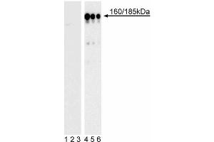 Western blot analysis of IRS-1 (pY896) in transformed human epithelial cells. (IRS1 antibody  (pTyr896))