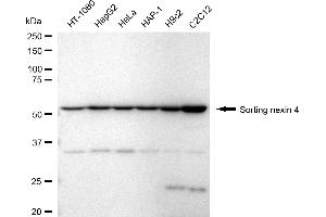 Western blotting analysis using sorting nexin 4 antibody (ABIN7800409).