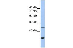 Western Blotting (WB) image for anti-Zinc Finger, ZZ-Type Containing 3 (ZZZ3) (Middle Region) antibody (ABIN928397)
