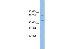 WB Suggested Anti-MDH1B Antibody Titration: 0. (MDH1B antibody  (Middle Region))
