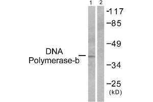 Western blot analysis of extracts from NIH/3T3 cells, using DNA Polymerase beta antibody (ABIN5976381). (POLB antibody  (C-Term))