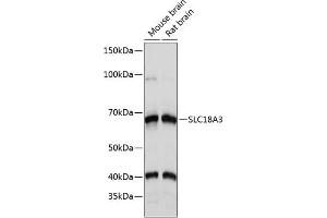 Western blot analysis of extracts of various cell lines, using SLC18 Polyclonal Antibody (ABIN7270410) at 1:1000 dilution. (SLC18A3 antibody  (AA 1-150))