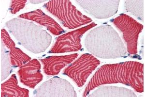 Human Skeletal Muscle (formalin-fixed, paraffin-embedded) stained with EBAG9 antibody ABIN351484 at 3. (RCAS1 antibody  (AA 240-251))