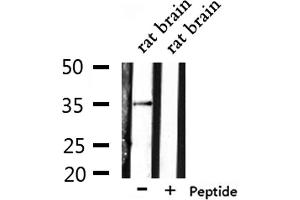Western blot analysis of extracts from rat brain, using OR6N1 Antibody. (OR6N1 antibody)
