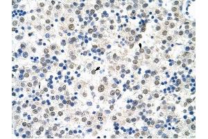 HSP90B1 antibody was used for immunohistochemistry at a concentration of 4-8 ug/ml to stain Hepatocytes (arrows) in Human Liver. (GRP94 antibody)