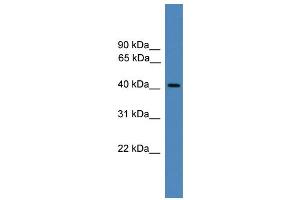 WB Suggested Anti-PSMC6 Antibody Titration: 0. (PSMC6 antibody  (C-Term))