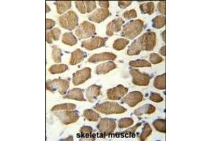 Immunohistochemistry (Paraffin-embedded Sections) (IHC (p)) image for anti-Kelch Repeat and BTB (POZ) Domain Containing 13 (KBTBD13) (AA 409-438), (C-Term) antibody (ABIN656073)