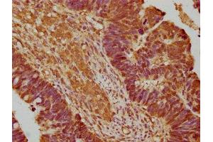 IHC image of ABIN7139711 diluted at 1:200 and staining in paraffin-embedded human ovarian cancer performed on a Leica BondTM system. (ENHO antibody  (AA 37-54))