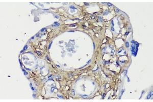 Immunohistochemistry of paraffin-embedded Human placenta using Decorin Polyclonal Antibody at dilution of 1:200 (40x lens). (Decorin antibody)