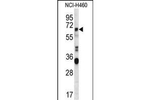 HERV-FRD Antibody (N-term) (ABIN656942 and ABIN2846131) western blot analysis in NCI- cell line lysates (35 μg/lane). (HERV-FRD Provirus Ancestral Env Polyprotein (Herv-frd) (AA 79-107), (N-Term) antibody)