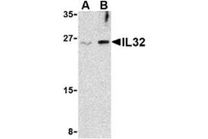 Image no. 1 for anti-Interleukin 32 (IL32) (Middle Region) antibody (ABIN318795)