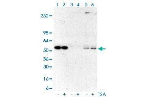 Immunoprecipitation analysis of Lane 1: A431 cell whole lysates, Lane 2: TSA-treated A431 cell whole lysates; Lane 3: A431 cell whole lysates, Lane 4: TSA-treated A431 cell whole lysates using rabbit IgG antibody; Lane 5: A431 cell whole lysates, Lane 6: TSA-treated A431 cell whole lysates using Acetylated-Lysine monoclonal antibody, clone RM101  at 1:500 dilution. (Acetylated Lysine antibody  (acetylated))